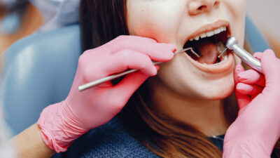 İ-Klinik Malatya Diş Kliniği: Gülüşünüz İçin Profesyonel Çözümler